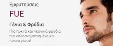 Εμφυτεύσεις FUE σε γένια, φρύδια, λοιπά σημεία σώματος, αποκατάσταση τριχοφυΐας ουλών