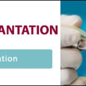 Innovation in Hair Transplantation Banner